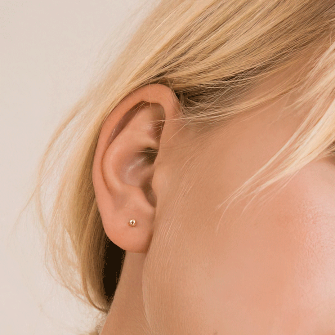 Aretes Esfera